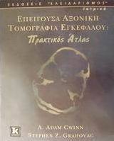 Επείγουσα αξονική τομογραφία εγκεφάλου