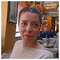 dim_poliorkitis