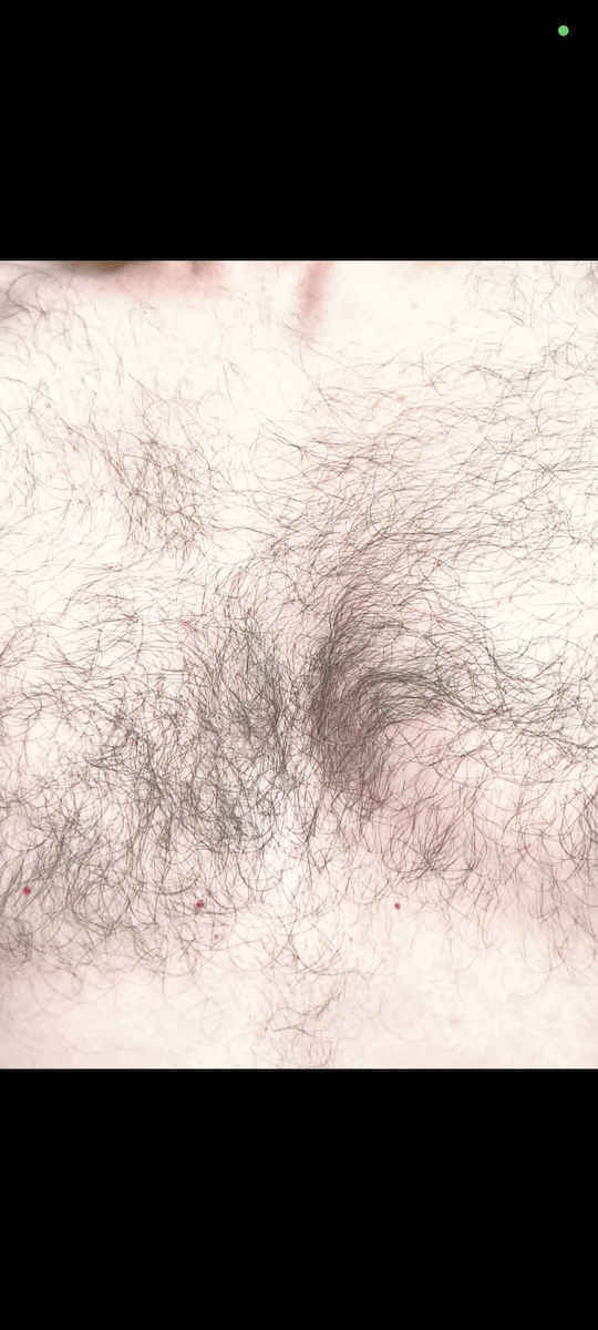 Boderm Bionatar Σαμπουάν κατά της Πιτυρίδας