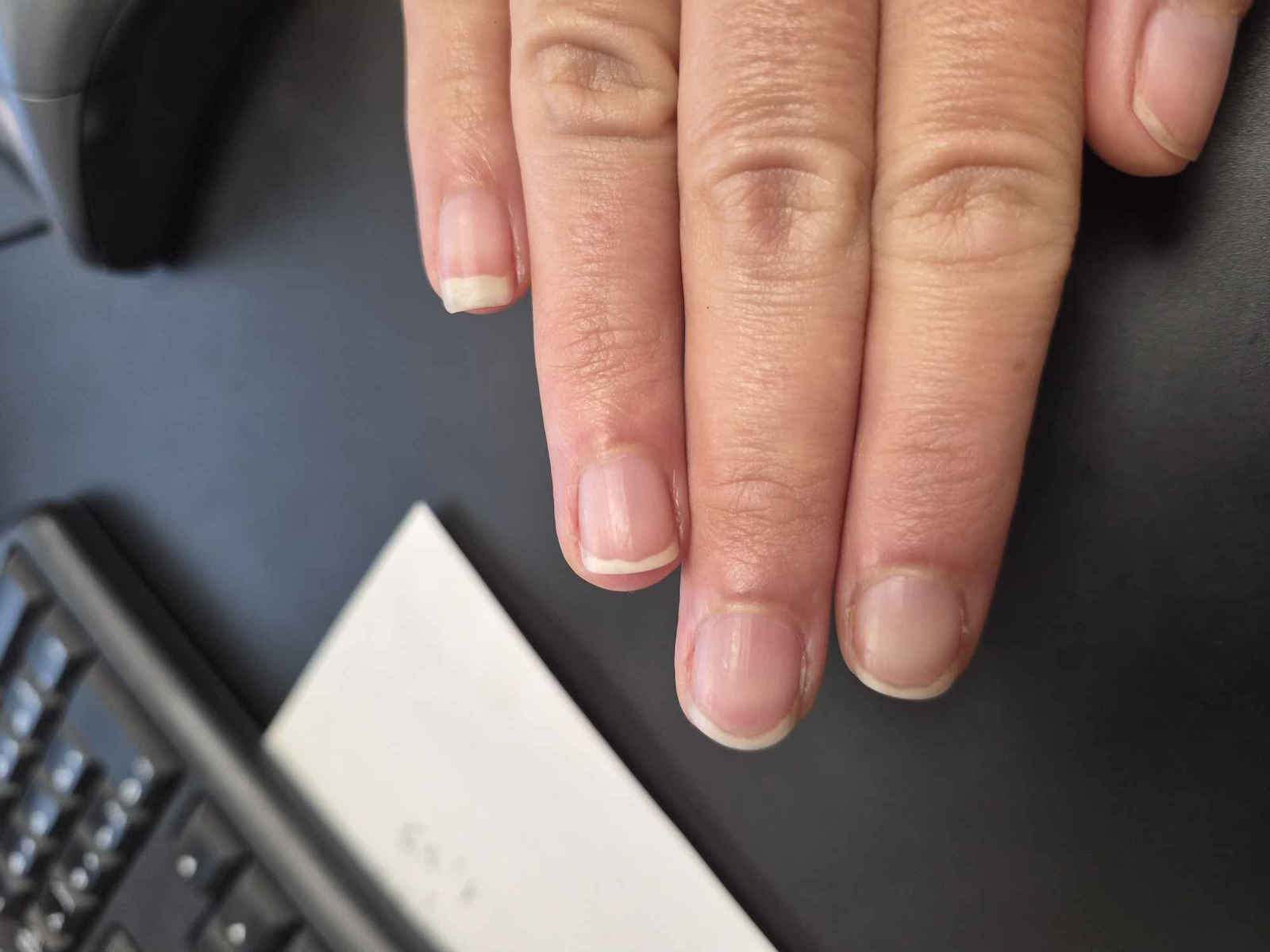 CND RescueRXx Treatment με Κερατίνη 3.7ml