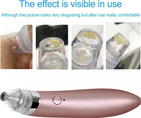 JB8620 Face Care Device
