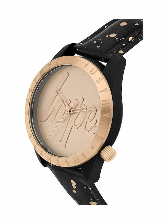 Hype Watch with Battery Mechanism Hype Watch with Battery Mechanism