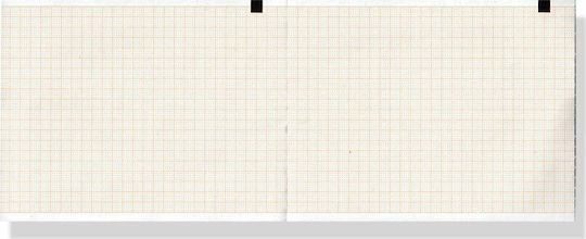 Gima Echocardiography Z-Fold Paper with 200 Sheets 110x140mm