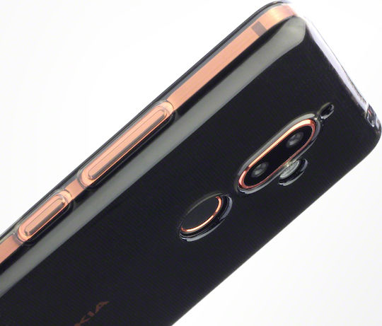 Terrapin TPU Gel Back Cover Σιλικόνης Μαύρο (Nokia 7 Plus)