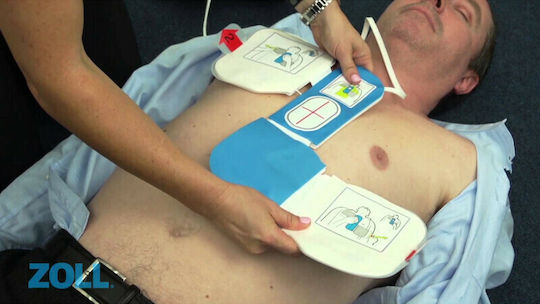 Zoll Αυτοκόλλητο Ηλεκτρόδιο Καρδιολογικό CPR-D Padz