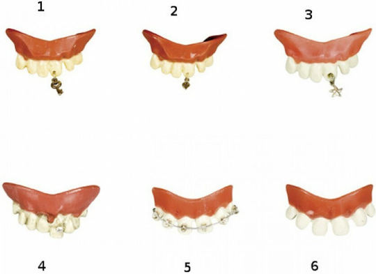 Carnival Teeth 1pcs (Μiscellaneous Designs/Colors)