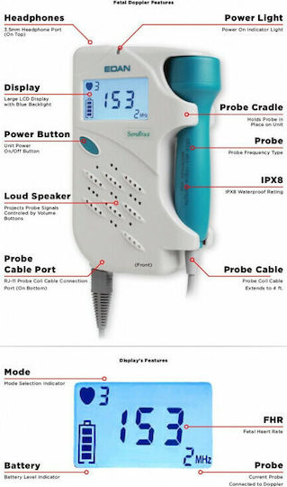 Edan Sonotrax Basic Ultraschallgerät