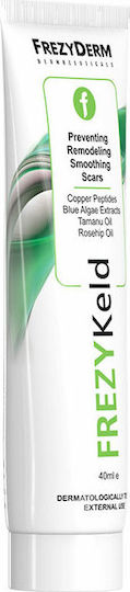 Frezyderm Frezykeld Κρέμα για Ουλές 40ml