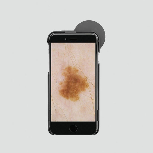 Heine iC1 Dermatoscope