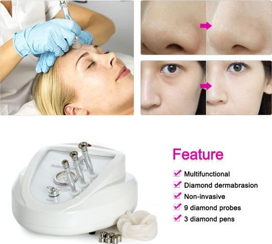 Konmison Dermabrasion Device with Power 18W 4kg