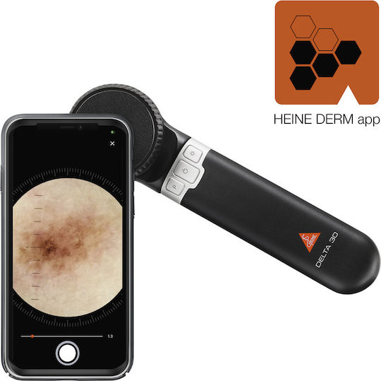 Heine Delta 30 Dermatoscope