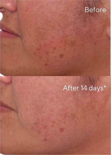 Murad Rapid Dark Spot Correcting Αντιγηραντικό Serum Προσώπου 30ml