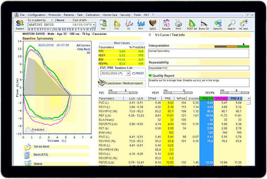 MIR Спирометър Spirobank Ii Advanced