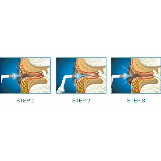 Bionix OtoClear Συσκευή Πλύσεως Αυτιών