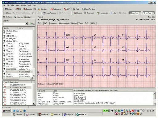 Welch Allyn CP50 Καρδιογράφος 12-Κάναλος
