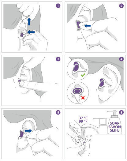 Alpine SleepDeep Silicone Earplugs in White Colour 111.21.158 2 Pieces
