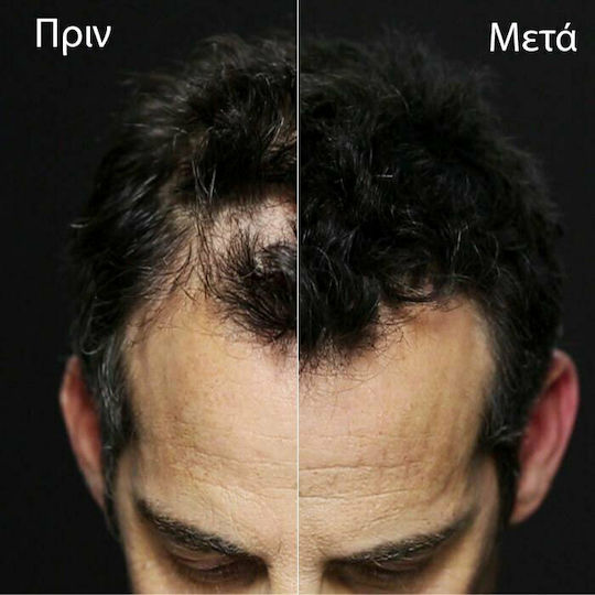 Toppik Hair Building Fibers with Keratin Hair Building Fibers Giant Medium Brown 55gr