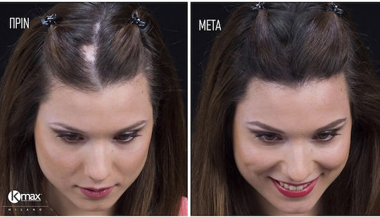 Kmax Milano Hair Thinning Coverage Fibers with Keratin Hair Fibers Regular 15g