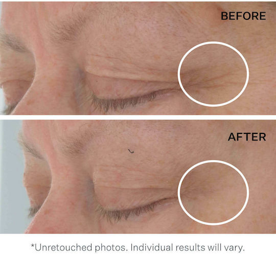 StriVectin Tripeptide Eye Moisturizer Gel for Hydration & Dark Circles 15ml