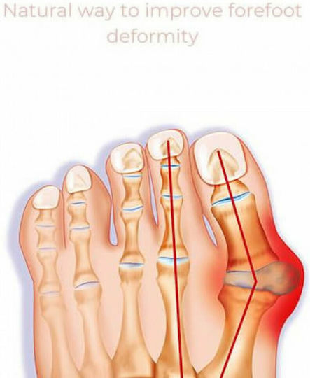 Toe Supporter Covers for Bunion 2 Pieces