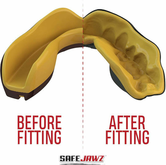 Safejawz Extro 2.0 Goldie Защитна устна гарнитура Младши Черен