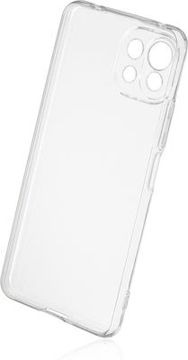 Naxius 1mm Back Cover Σιλικόνης Διάφανο (Mi 11 Lite / 11 Lite 5G / 11 Lite 5G NE)