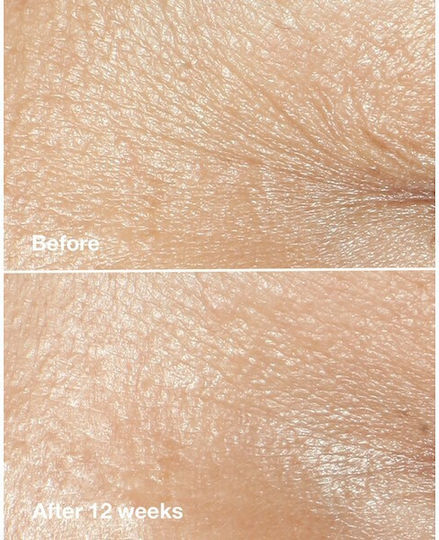 Clinique Smart Clinical Cremă Anti-îmbătrânire pentru Față cu Acid Hialuronic și Colagen 15ml