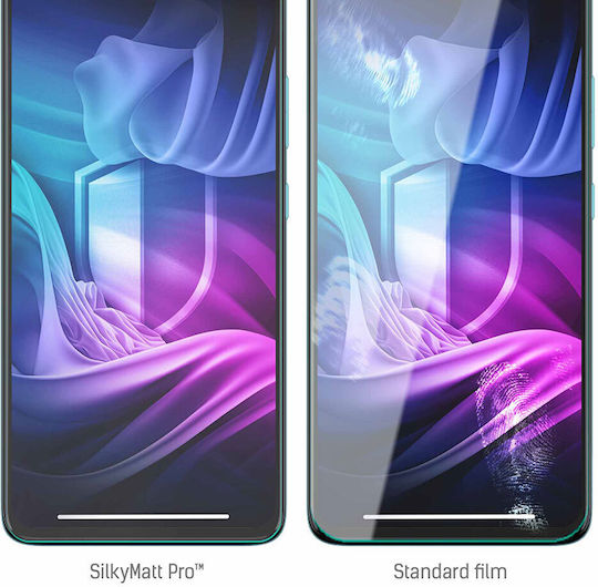 3MK Matt Pro Screen Protector (Moto G72)