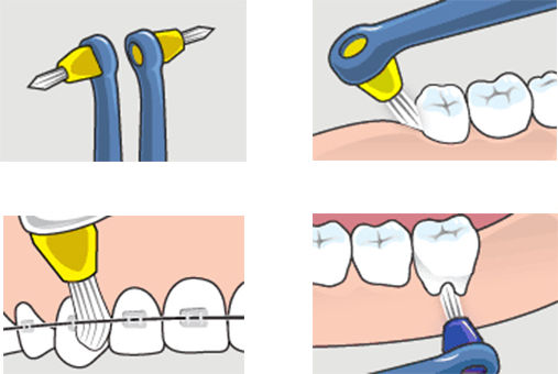 TePe Interspace Manual Toothbrush Ultra Soft White 1pcs