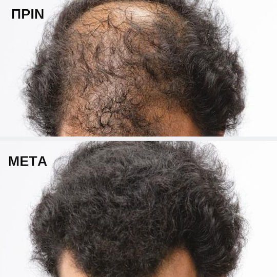 Toppik Hair Building Fibers with Keratin Hair Building Fibers Economy Medium Blonde 27.5gr