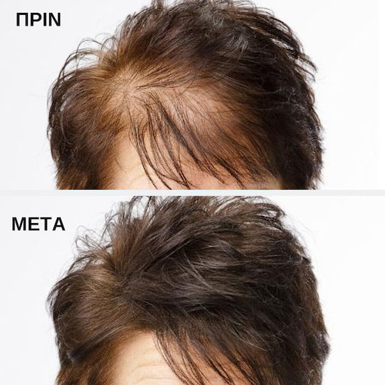 Toppik Hair Building Fibers with Keratin Hair Building Fibers Economy Medium Blonde 27.5gr