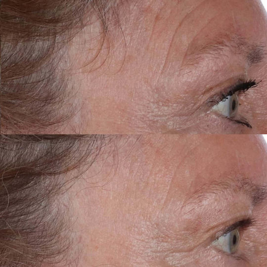 Perricone MD Cold Plasma Plus+ Ενυδατική Κρέμα Προσώπου με Νιασιναμίδη & Πεπτίδια 140ml