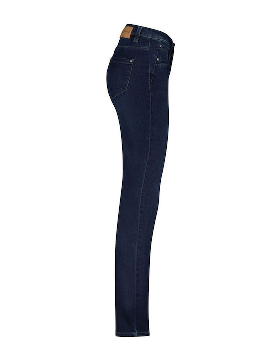 Γυναικείο Jean Παντελόνι σε Skinny Εφαρμογή