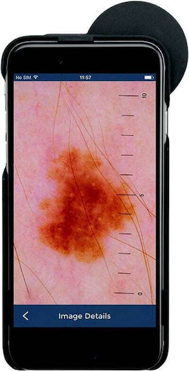 Heine iC1 Dermatoscope