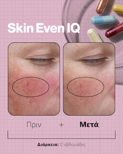 Advanced Nutrition Programme Skin Even Iq Ειδικό Συμπλήρωμα Διατροφής 140 κάψουλες