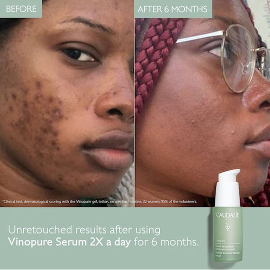 Caudalie Vinopure Blemish Control Serum Face with Niacinamide & Salicylic Acid for Radiance & Firming 30ml