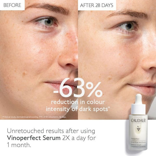 Caudalie Vinoperfect Radiance Complexion Correcting Anti-Aging Serum Gesicht 30ml
