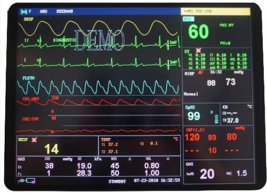 Edan M9 Monitor Ιατρικών Μηχανημάτων