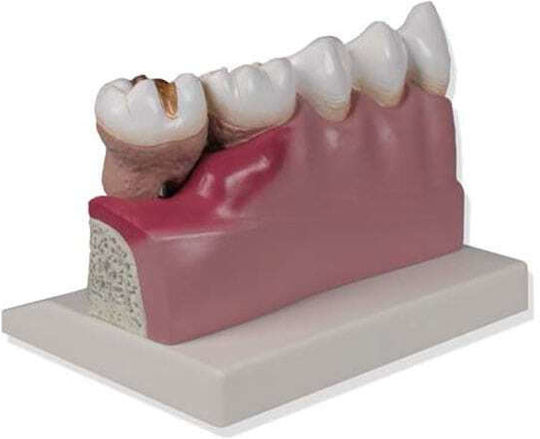 Erler Zimmer Internal Organs Model