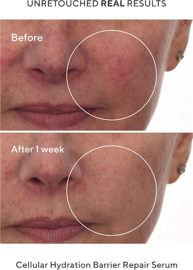 Murad Cellular Hydration Barrier Repair Ενυδατικό & Αντιγηραντικό Serum Προσώπου με Πεπτίδια & Υαλουρονικό Οξύ για Θρέψη 28gr