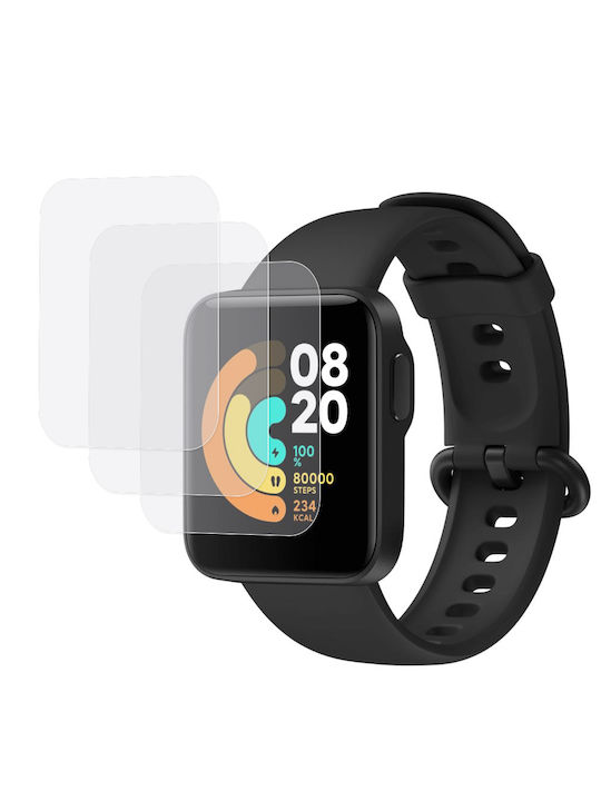 Erbord Displayschutzfolie für das Mi Watch Lite 1Stück
