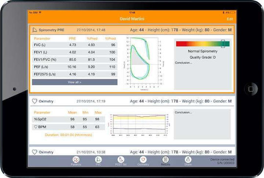 MIR Spirometru Spirobank Ii Basic 60 Turbine