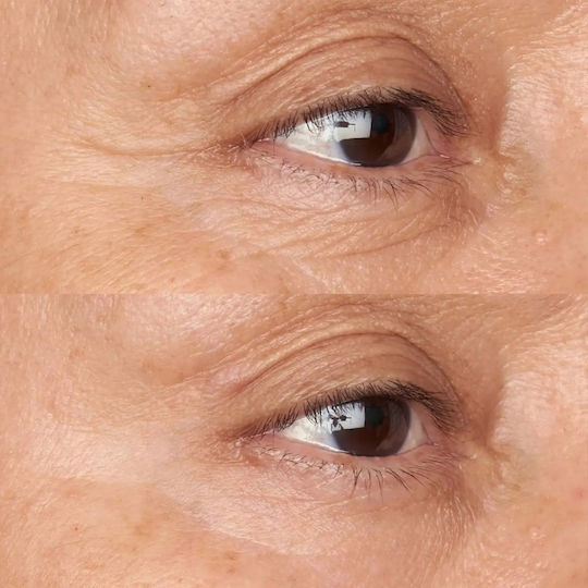 Perricone MD Κρέμα Ματιών για Ανάπλαση & Λάμψη 15ml