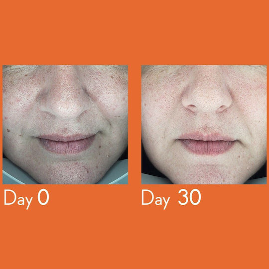 Youth Lab Promo Dark Spot Remover Serum 30ml & Βrightening Vit-c Gel Cream 20ml & Βrightening Vit-c Hydra-gel Eye Patches 1 Τμχ