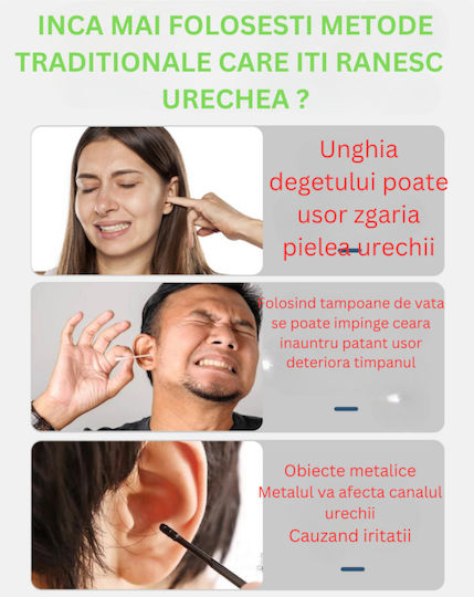 Endoscop inteligent de curățare a urechilor 5mp Full Hd Camera Led Lumina Wi-fi Accesorii incluse Kit de încărcare 350 Mah Baterie impermeabilă Ip67 negru