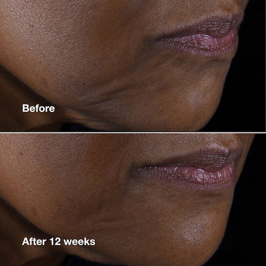 Clinique Smart Clinical Repair Rich Κρέμα Προσώπου για Ενυδάτωση, Αντιγήρανση & Σύσφιξη με Υαλουρονικό Οξύ & Πεπτίδια 75ml