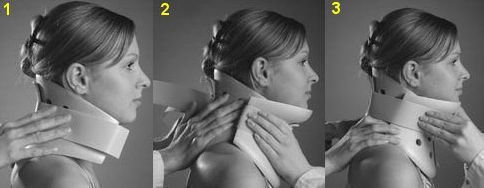 Philadelphia Type Neck Support 79-83143