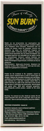 Erythro Forte Sun Burn After Sun Κρέμα με Aloe Vera & Πανθενόλη 100ml