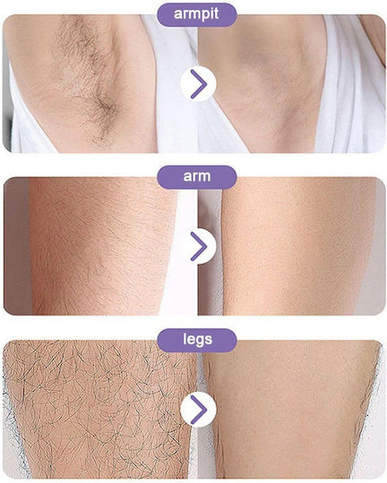 Epilator IPL pentru față, corp și bikini