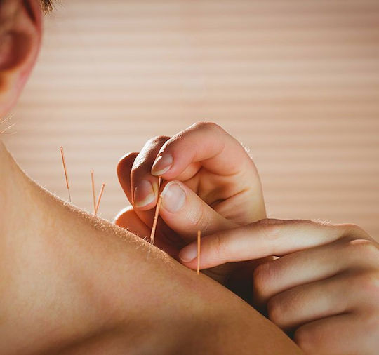 Ace Acupunctura Acupunctura Ace 500 Ace 022x30